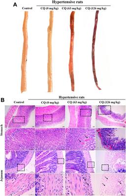 Hypertension related toxicity of chloroquine explains its failure against COVID-19: Based on rat model